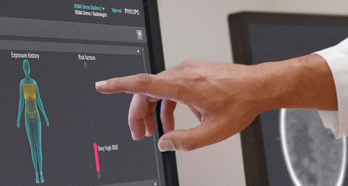 Philips background Image zahlreiche Tools zum Dosismanagement