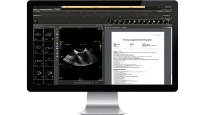 Imagen en miniatura de la pantalla de IntelliSpace Cardiovascular