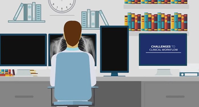 Vídeo de la solución Radiology Workspace