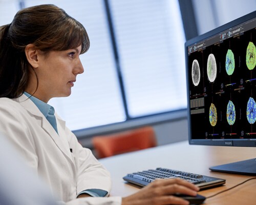 Doctora que utiliza Diagnostic Viewer para examinar imágenes de RM con perfusión