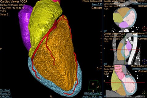 CT Comprehensive Cardiac Analysis