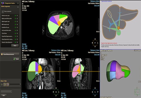 imagen clínica de mr liver health