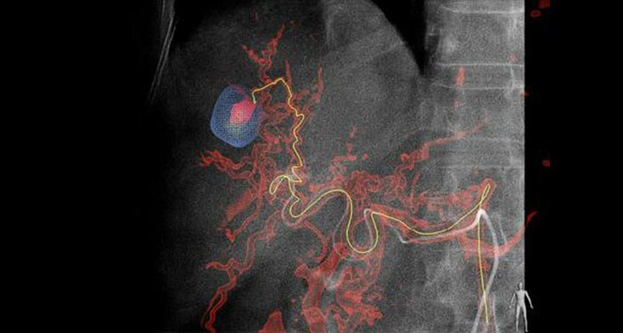 emboguide_interventional_xray_systems