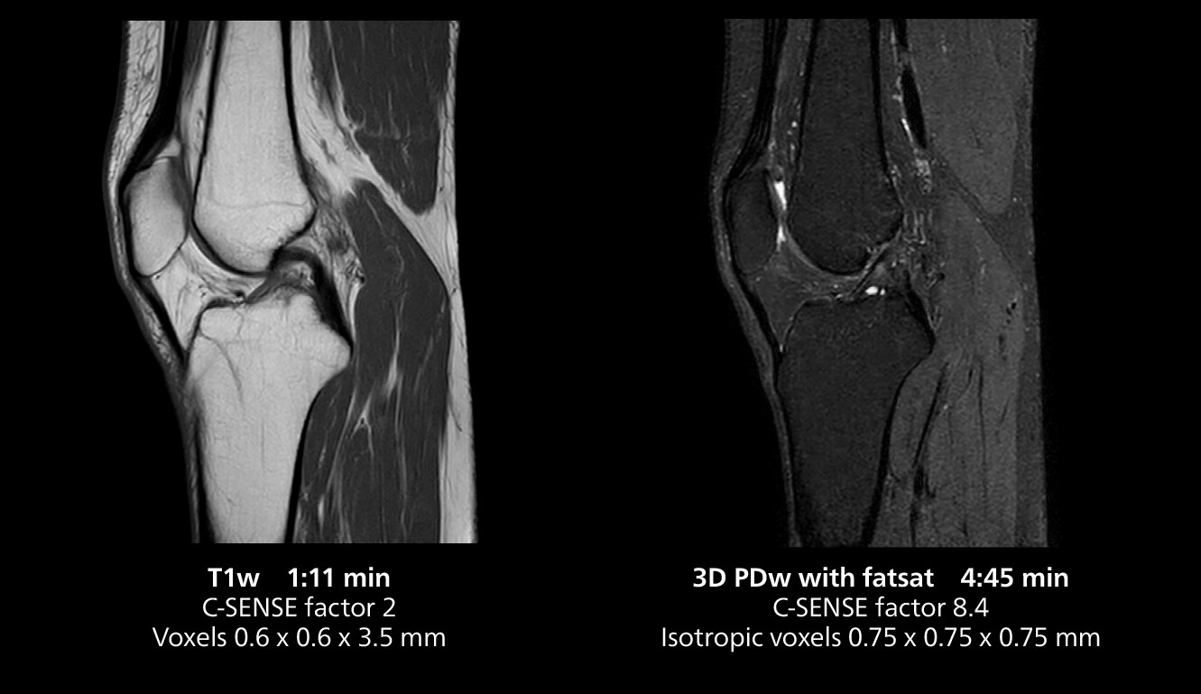 RM de rodilla uno