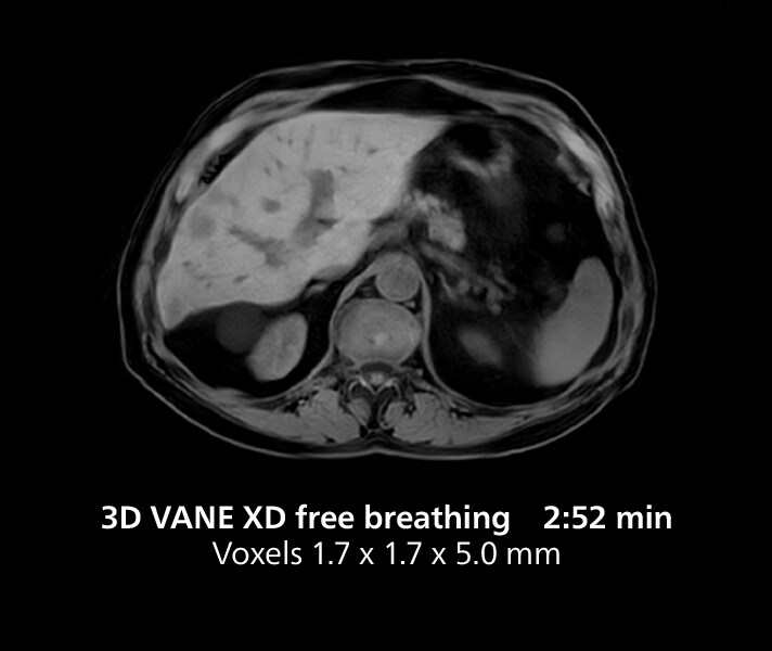 3D de respiración libre