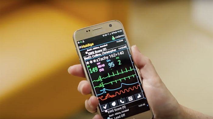 Uso de dispositivos móviles para gestionar las alarmas de monitorización con el vídeo de Philips CareEvent