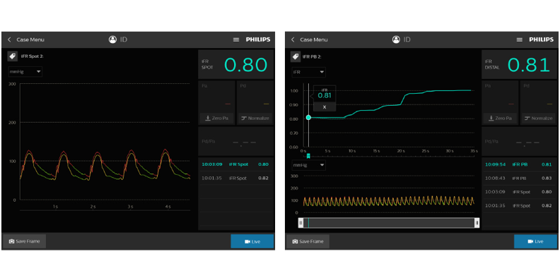 Imagen de descarga del monitor de iFR (download .png)