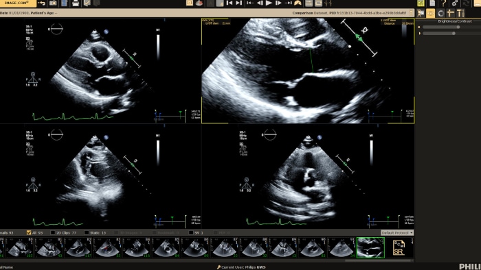 Ultrasound Workspace