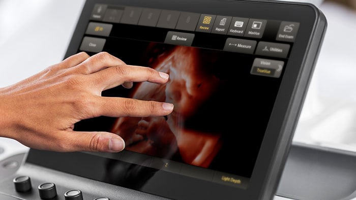 Ultrasonidos para obstetricia con Philips TrueVue