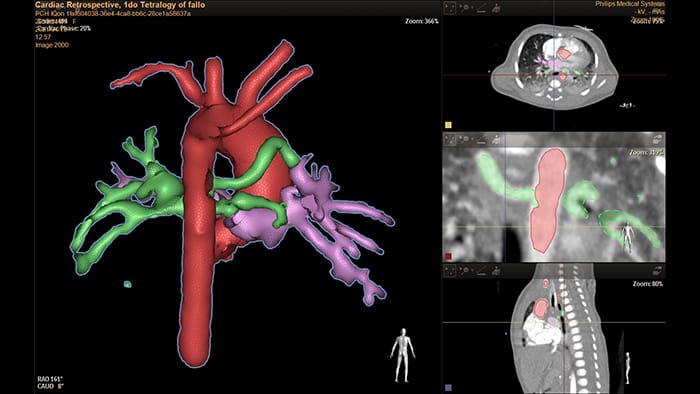 Hemo con estaci&oacute;n de trabajo IntelliVue&nbsp;X3