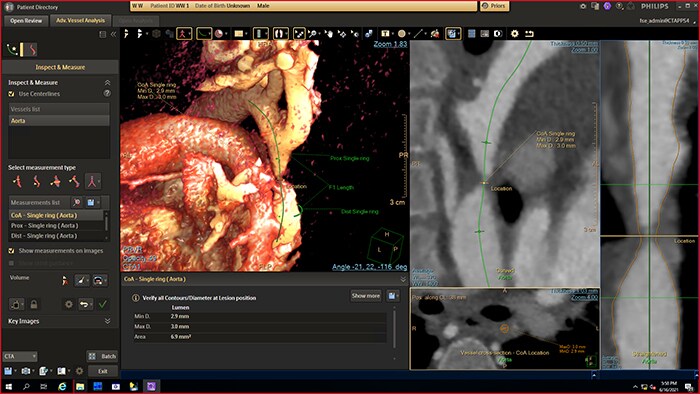 IntelliSpace Cardiovascular