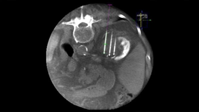 Imagen 3D CBCT con Dual View