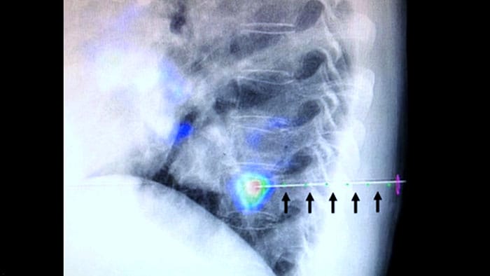 XperGuide y CBCT