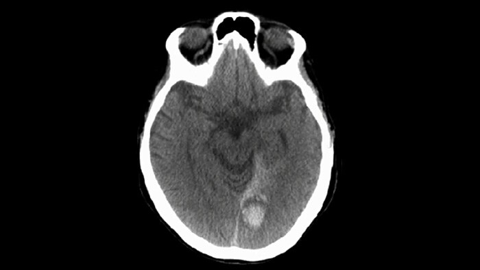 CBCT (similar a TC)