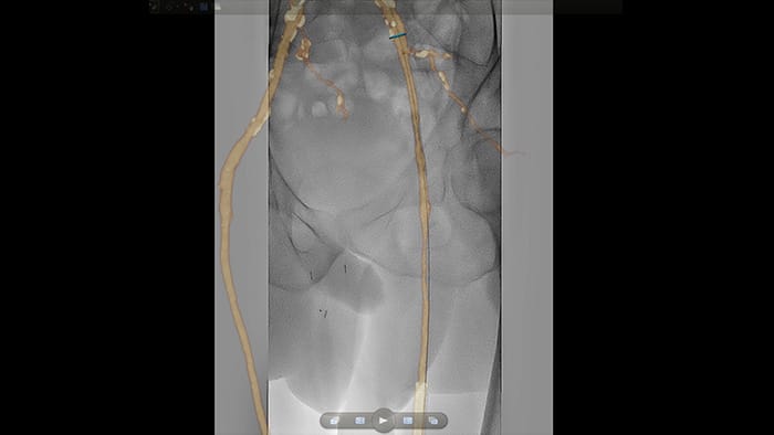 Mapa 3D VesselNavigator