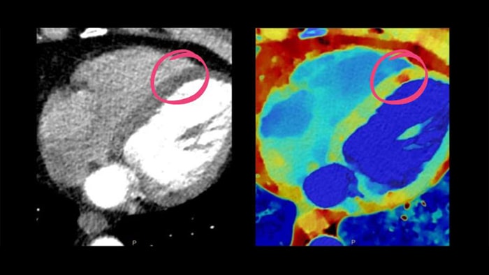 Herramienta de diagnóstico cardiaco