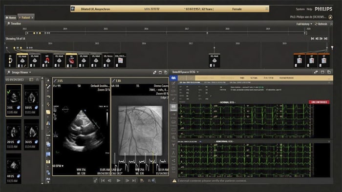 Información de diagnóstico cardiovascular