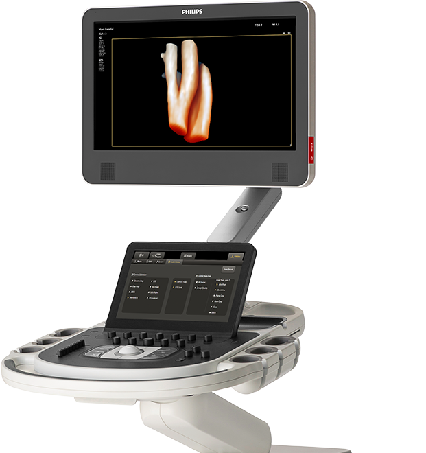 Potenciar el rendimiento de obtención de imágenescon la evaluación vascular 3D