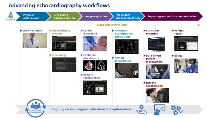 Avances en los flujos de trabajo de ecocardiografía