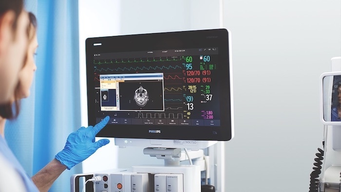 Primer plano del monitor Philips en uso