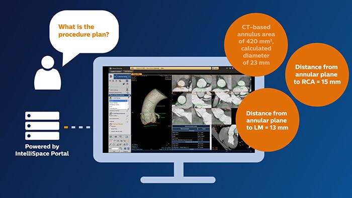 Miniatura de video de imagenes cardiovasculares