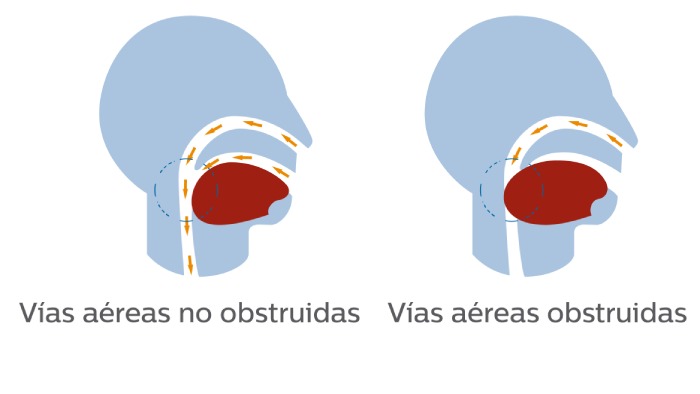 Manejo del asma en el que puede confiar