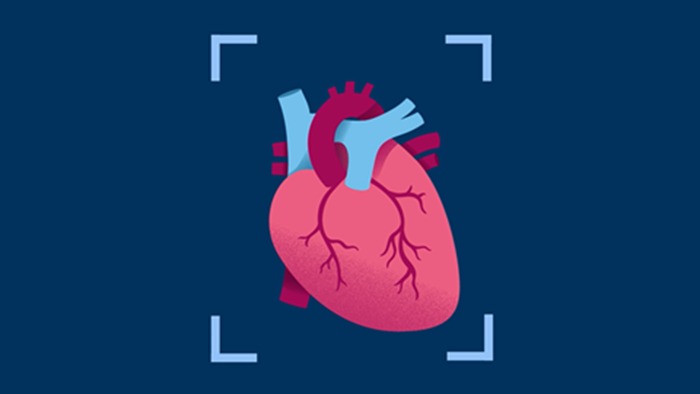 Video cardiaco