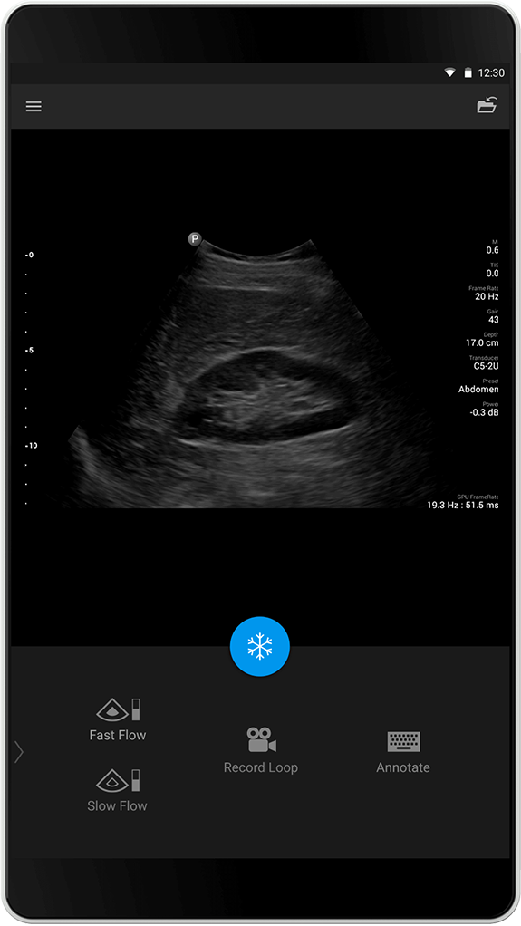 Abdomen exam C5-2