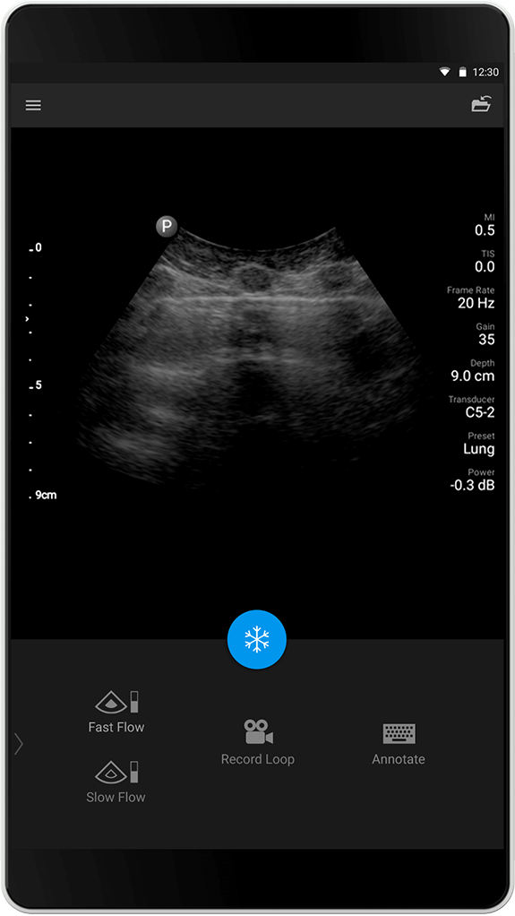 Lung exam C5-2