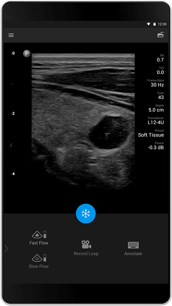 Soft tissue exam