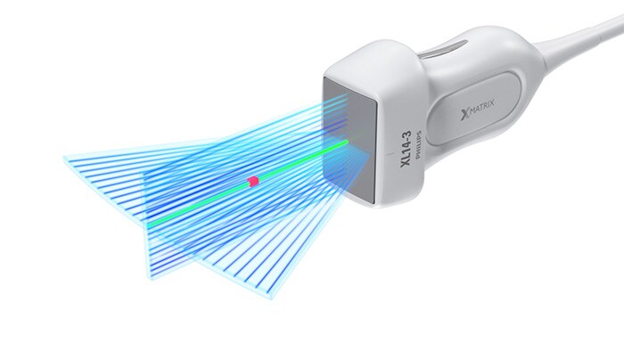 Transductor de array lineal XL14-3 xMATRIX para evaluaciones vasculares de Philips con xPlane Doppler