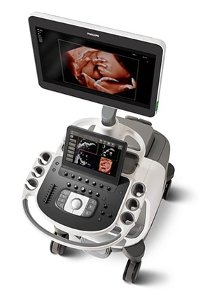 Sistema de ultrasonidos Epiq 7 de Philips para obstetricia y ginecología