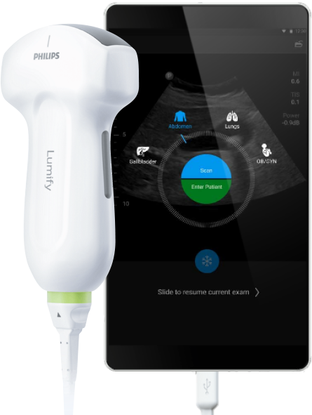 Philips Lumify aplicación