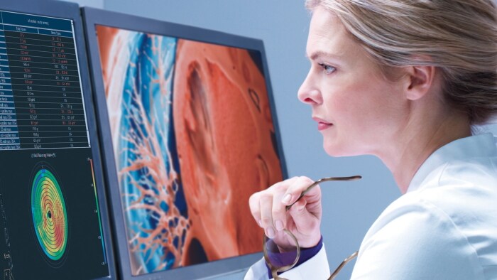 Philips presenta sus soluciones integradas de radiología asistida por IA en el congreso RSNA 2020