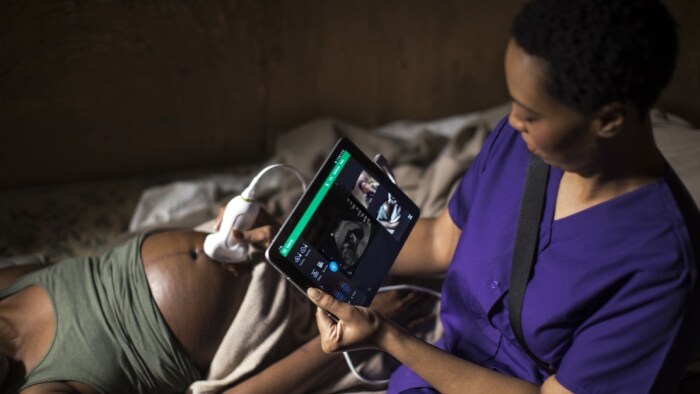 El sistema de ultrasonido portátil Lumify es reconocido por su beneficio a la humanidad con el IEEE Spectrum Technology
