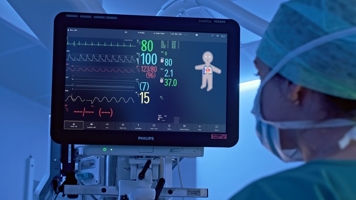 Los monitores IntelliVue de Philips presentan nuevas soluciones que mejoran la experiencia de pacientes y profesionales