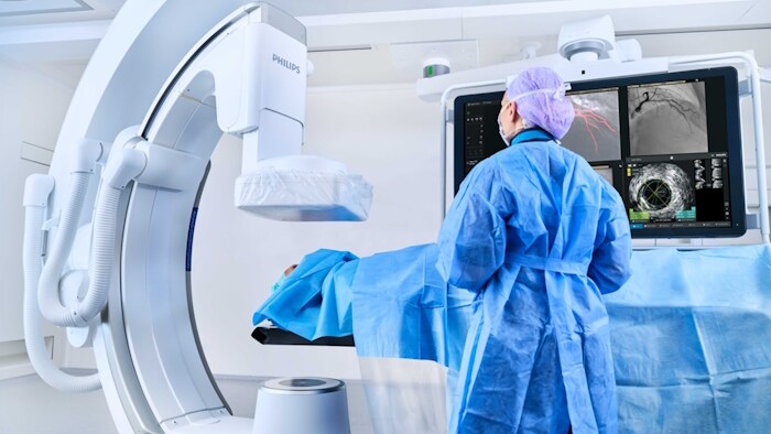 Philips lanza un algoritmo que reduce la radiación y mejora la calidad de imagen en procedimientos coronarios