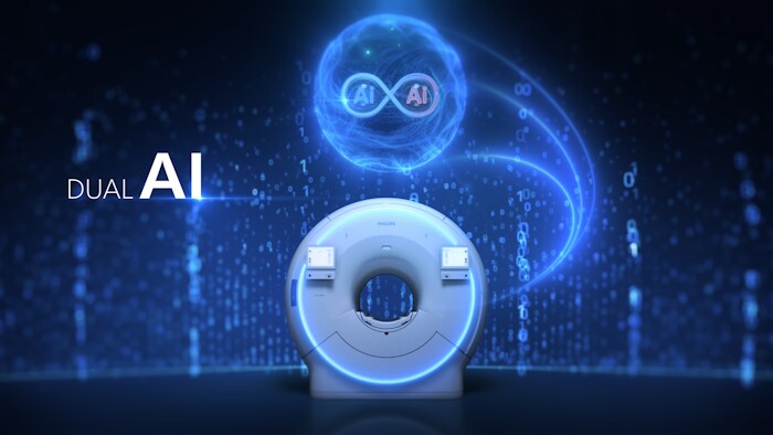 SmartSpeed Dual AI -  