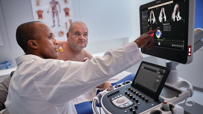 Trascend Plus - Ecografía cardiovascular - Philips -  