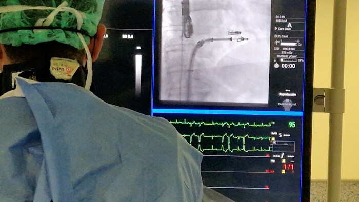 El HUCA realiza la primera intervención cardiaca en España guiada por la sonda VeriSight Pro 3D