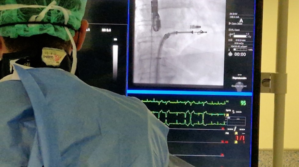 VeriSightPro 3D en uso - Detalle cateter ICE - HUCA