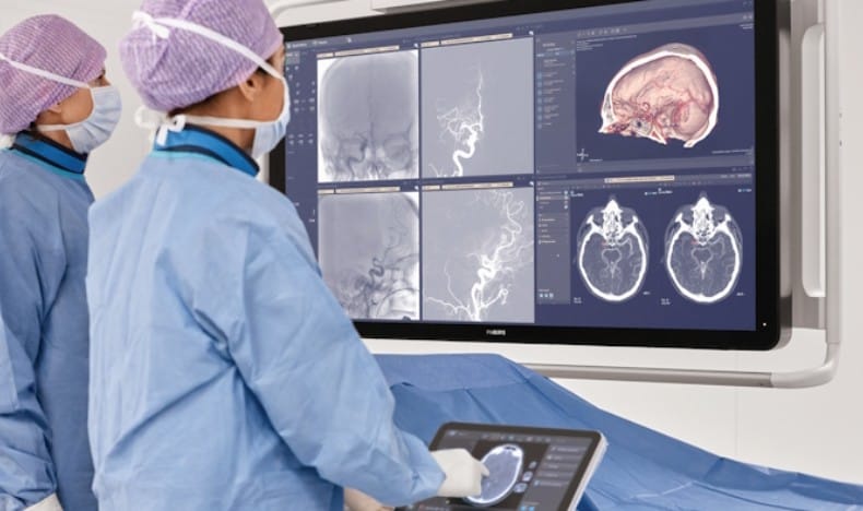 Azurion 7C20 &ndash; SmartCT Dual