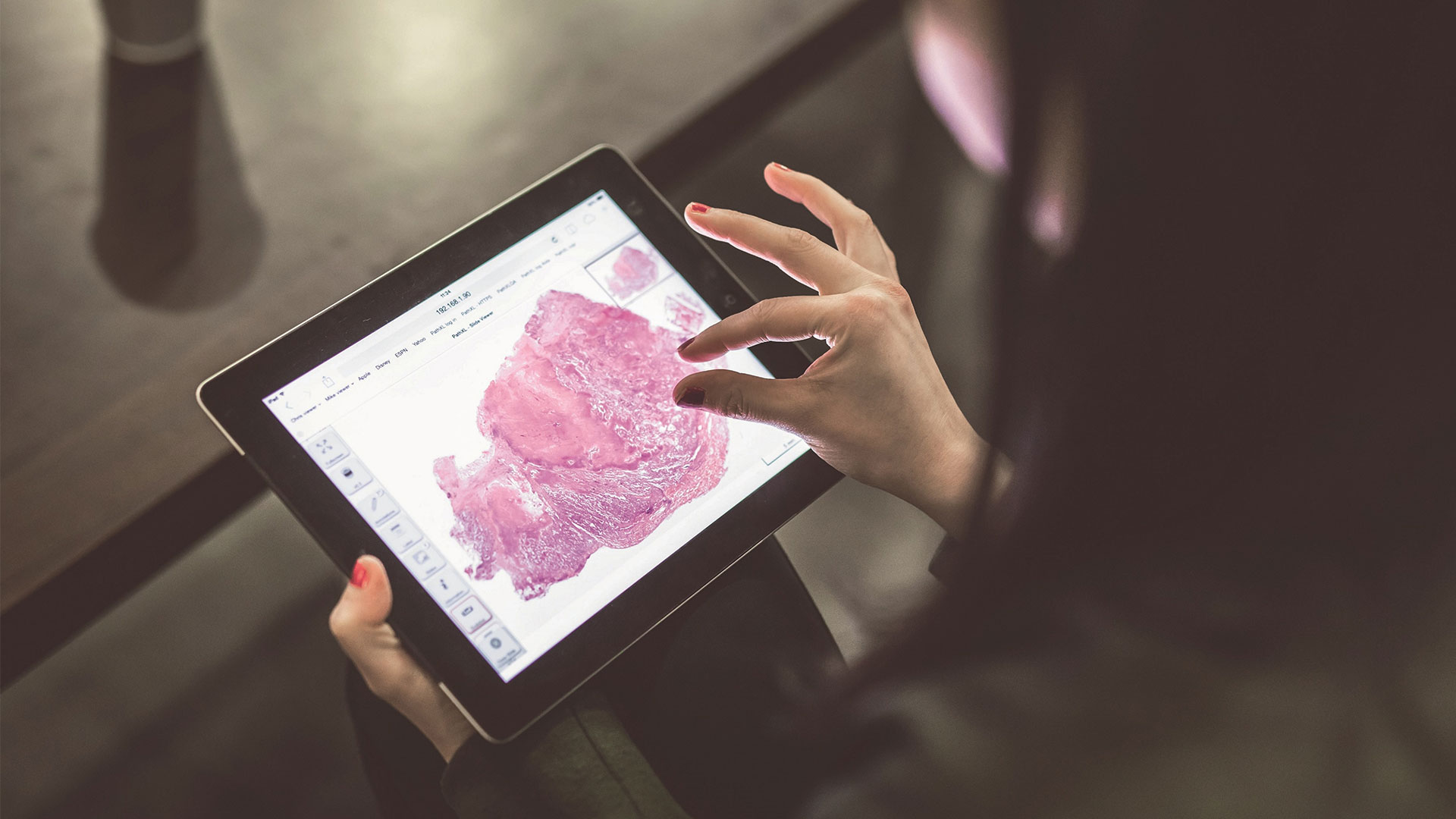 PATHOLOGY INTELLISITE ANATOMIA PATOLOGICA PHILIPS