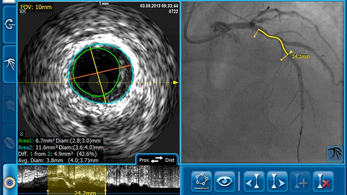 ivus co registro