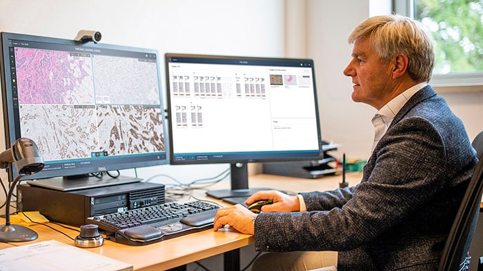 Philips impulsa la patología digital con informática avanzada para mejorar el diagnóstico de precisión en oncología