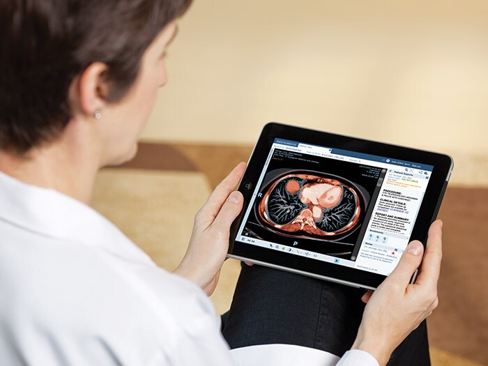 Download image (.jpg) Philips Image Viewer Vue Motion for Clinicans (Se abre en una nueva ventana)