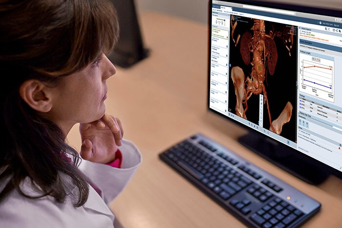 Download image (.jpg) Philips Vue Motion for Radiologists (Se abre en una nueva ventana)