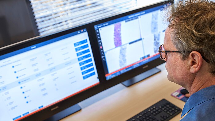Philips presenta la nueva generación IntelliSite para mejorar el diagnóstico y los flujos de trabajo del laboratorio de patología