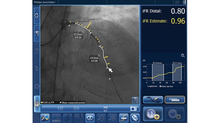 Download image (.jpg) Philips Ingenia MR-RT
