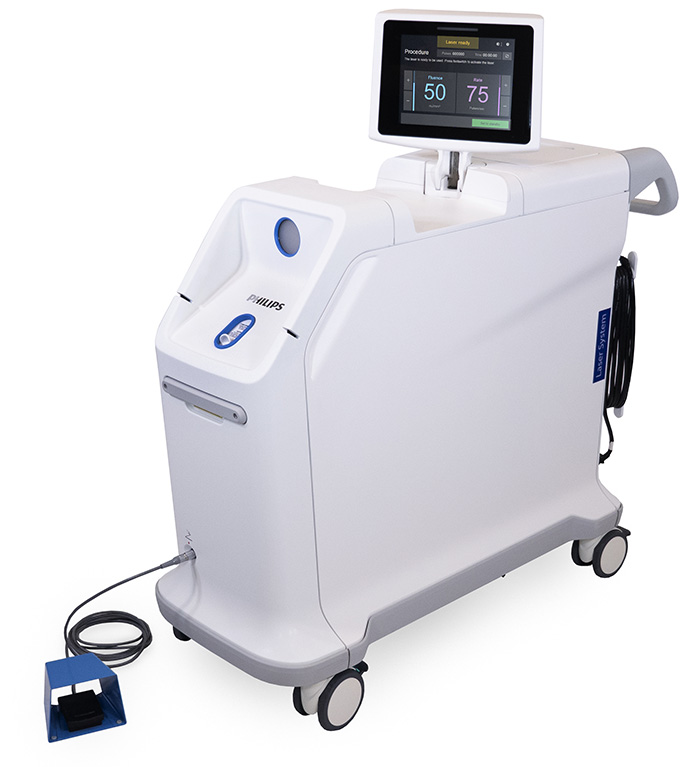 Download image (.jpg) Philips Laser System (Se abre en una nueva ventana)